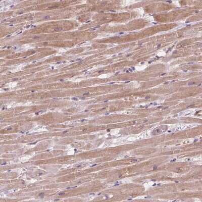 Immunohistochemistry: TASK-5/KCNK15 Antibody [NBP2-39038] - Staining of human heart muscle shows moderate cytoplasmic positivity in myocytes.