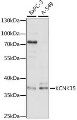 Western Blot: TASK-5/KCNK15 Antibody [NBP2-93885] - Analysis of extracts of various cell lines, using TASK-5/KCNK15 at 1:1000 dilution.Secondary antibody: HRP Goat Anti-Rabbit IgG (H+L) at 1:10000 dilution.Lysates/proteins: 25ug per lane.Blocking buffer: 3% nonfat dry milk in TBST.Detection: ECL Basic Kit .Exposure time: 60s.