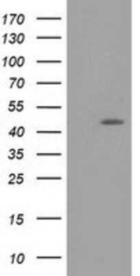 Western Blot: TASP1 Antibody (1H6) [NBP2-03481] HEK293T cells were transfected with the pCMV6-ENTRY control (Left lane) or pCMV6-ENTRY TASP1 (Right lane) cDNA for 48 hrs and lysed. Equivalent amounts of cell lysates (5 ug per lane) were separated by SDS-PAGE and immunoblotted with anti-TASP1.