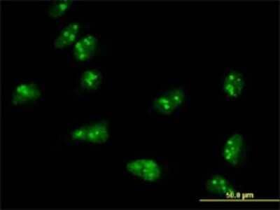 Immunocytochemistry/Immunofluorescence: TASP1 Antibody (3E10) [H00055617-M01] - Analysis of monoclonal antibody to TASP1 on HeLa cell . Antibody concentration 10 ug/ml.
