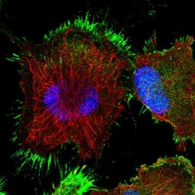 Immunocytochemistry/Immunofluorescence: TASP1 Antibody [NBP1-88307] - Immunofluorescent staining of human cell line U-251 MG shows localization to plasma membrane.