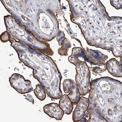 Immunohistochemistry-Paraffin: TASP1 Antibody [NBP1-88307] - Staining of human placenta shows strong membranous positivity in trophoblastic cells.