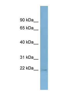 Western Blot: TASP1 Antibody [NBP1-56869] - MCF-7 whole cell lysates, concentration 0.2-1 ug/ml.