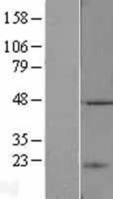 Western Blot: TASP1 Overexpression Lysate (Adult Normal) [NBL1-16714] Left-Empty vector transfected control cell lysate (HEK293 cell lysate); Right -Over-expression Lysate for TASP1.