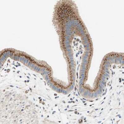 Immunohistochemistry-Paraffin: TATA Element Modulatory Factor 1 Antibody [NBP1-90117] - Staining of human gallbladder shows strong cytoplasmic positivity in glandular cells.