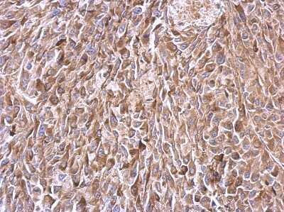 Immunohistochemistry-Paraffin: TATA Element Modulatory Factor 1 Antibody [NBP2-20572] - Immunohistochemical analysis of paraffin-embedded RT2 xenograft, using antibody at 1:500 dilution.