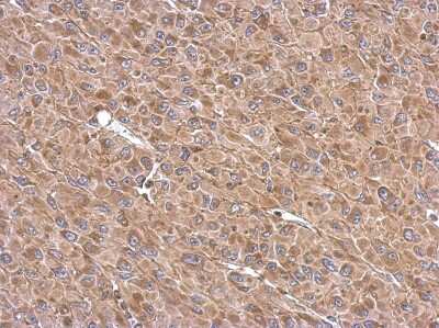 Immunohistochemistry-Paraffin: TATA Element Modulatory Factor 1 Antibody [NBP2-20572] - Immunohistochemical analysis of paraffin-embedded U87 xenograft, using antibody at 1:500 dilution.