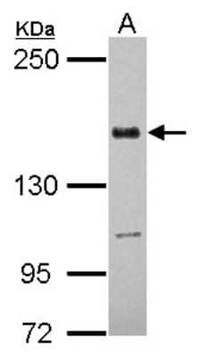 Western Blot: TATA Element Modulatory Factor 1 Antibody [NBP2-20572] - Sample (30 ug of whole cell lysate) A: U87-MG 5% SDS PAGE gel, diluted at 1:5000.