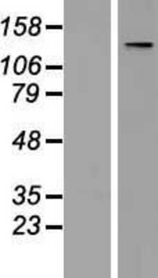 Western Blot TATA Element Modulatory Factor 1 Overexpression Lysate