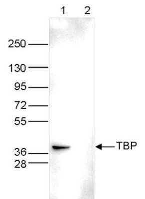 Western Blot: TATA binding protein TBP Antibody (C.15200002) [NBP2-59208] - Whole cell extracts (40 ug) from HeLa cells transfected with TBP siRNA (lane 2) and from an untransfected control (lane 1) were analysed by Western blot using the antibody against TBP diluted 1:500 in TBSTween containing 5% skimmed milk. The position of the protein of interest is indicated on the right; the marker (kDa) is shown on the left.