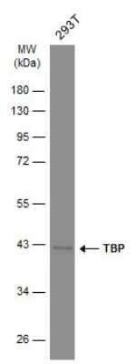 Western Blot: TATA binding protein TBP Antibody (GT453) [NBP3-13596] - Whole cell extract (30 ug) was separated by 10% SDS-PAGE, and the membrane was blotted with TATA binding protein TBP antibody (NBP3-13596) diluted at 1:1000. The HRP-conjugated anti-mouse IgG antibody (NBP2-19382) was used to detect the primary antibody.