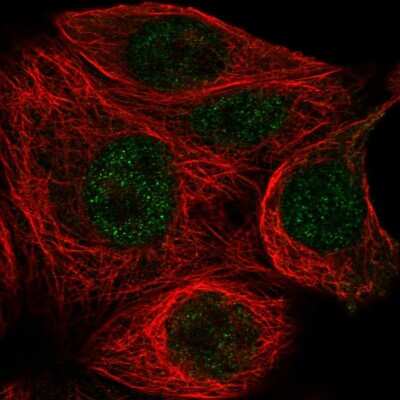 Immunocytochemistry/Immunofluorescence: TATA binding protein TBP Antibody [NBP2-38610] - Immunofluorescent staining of human cell line MCF7 shows localization to nucleoplasm.