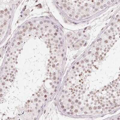 Immunohistochemistry: TATA binding protein TBP Antibody [NBP2-38610] - Staining of human testis shows weak nuclear positivity in cells in seminiferous ducts and Leydig cells.