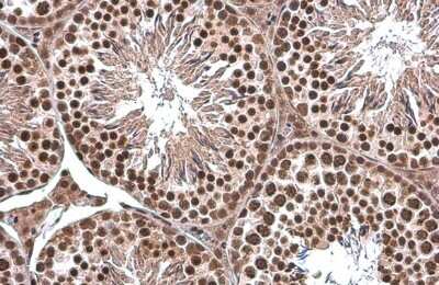 Immunohistochemistry-Paraffin: TATA binding protein TBP Antibody [NBP3-13174] - TATA binding protein TBP antibody detects TATA binding protein TBP protein at nucleus by immunohistochemical analysis. Sample: Paraffin-embedded mouse testis. TATA binding protein TBP stained by TATA binding protein TBP antibody (NBP3-13174) diluted at 1:500. Antigen Retrieval: Citrate buffer, pH 6.0, 15 min