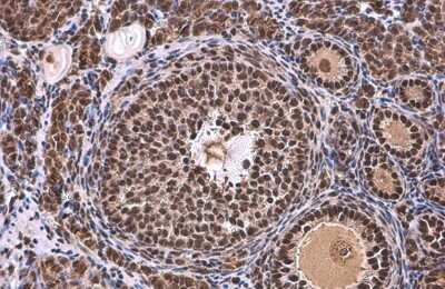 Immunohistochemistry-Paraffin: TATA binding protein TBP Antibody [NBP3-13174] - TATA binding protein TBP antibody detects TATA binding protein TBP protein at nucleus by immunohistochemical analysis. Sample: Paraffin-embedded mouse ovary. TATA binding protein TBP stained by TATA binding protein TBP antibody (NBP3-13174) diluted at 1:500. Antigen Retrieval: Citrate buffer, pH 6.0, 15 min