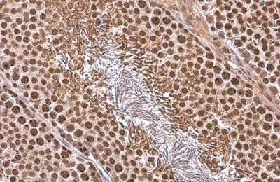 Immunohistochemistry-Paraffin: TATA binding protein TBP Antibody [NBP3-13174] - TATA binding protein TBP antibody detects TATA binding protein TBP protein at nucleus by immunohistochemical analysis. Sample: Paraffin-embedded rat testis. TATA binding protein TBP stained by TATA binding protein TBP antibody (NBP3-13174) diluted at 1:500. Antigen Retrieval: Citrate buffer, pH 6.0, 15 min