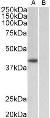 Western Blot: TATA binding protein TBP Antibody [NBP2-12933] - NBP2-12933 (1ug/ml) staining of HeLa nuclear (A) and cytosolic (B) lysates (35ug protein in RIPA buffer). Primary incubation was 1 hour. Detected by chemiluminescence.