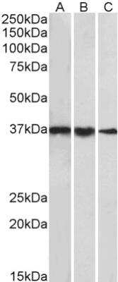 Western Blot: TATA binding protein TBP Antibody [NBP2-12933] - Analysis of cell line NIH3T3 (A), Mouse Testis (B) and Rat Testis (C) lysates (35 ug protein in RIPA buffer). Primary incubation was 1 hour. Detected by chemiluminescence