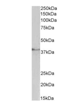 Western Blot: TATA binding protein TBP Antibody [NBP2-12933] - Staining of Pig Testis lysate (35 ug protein in RIPA buffer). Primary incubation was 1 hour. Detected by chemiluminescence