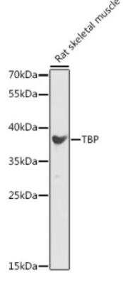 Western Blot: TATA binding protein TBP Antibody [NBP2-95183] - Analysis of extracts of Rat skeletal muscle, using TBP antibody  at 1:1000 dilution.Secondary antibody: HRP Goat Anti-Rabbit IgG (H+L) at 1:10000 dilution.Lysates/proteins: 25ug per lane. Blocking buffer: 3% nonfat dry milk in TBST.Detection: ECL Enhanced Kit. Exposure time: 90s.