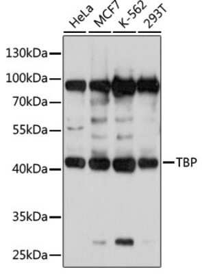 Western Blot: TATA binding protein TBP Antibody [NBP3-02958] - Analysis of extracts of various cell lines, using TATA binding protein TBP antibody at 1:1000 dilution. Secondary antibody: HRP Goat Anti-Rabbit IgG (H+L) at 1:10000 dilution. Lysates/proteins: 25ug per lane. Blocking buffer: 3% nonfat dry milk in TBST. Detection:Basic ECL Kit