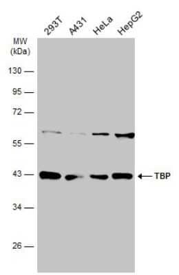 Western Blot: TATA binding protein TBP Antibody [NBP3-13174] - Various whole cell extracts (30 ug) were separated by 10% SDS-PAGE, and the membrane was blotted with TATA binding protein TBP antibody (NBP3-13174) diluted at 1:1000. The HRP-conjugated anti-rabbit IgG antibody (NBP2-19301) was used to detect the primary antibody.