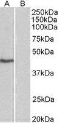 Western Blot: TATA binding protein TBP isoform 1 Antibody [NBP2-12932] - TATA binding protein TBP isoform 1 Antibody 0.3ug/ml staining of HeLa nuclear (A) and cytosolic (B) lysates (35ug protein in commercial extraction buffer). Primary incubation was 1 hour. Detected by chemiluminescence.