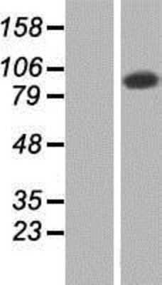 Western Blot: TATDN2 Overexpression Lysate (Adult Normal) [NBP2-07279] Left-Empty vector transfected control cell lysate (HEK293 cell lysate); Right -Over-expression Lysate for TATDN2.