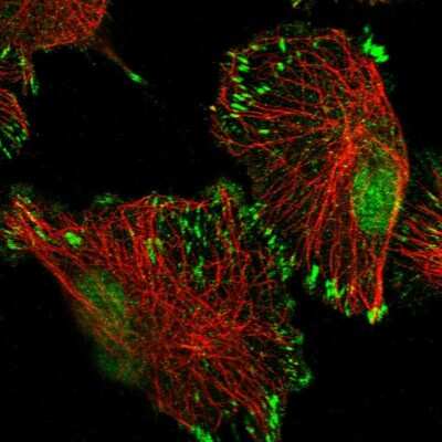 Immunocytochemistry/Immunofluorescence: TATDN3 Antibody [NBP1-91010] - Immunofluorescent staining of human cell line U-251 MG shows localization to nucleoplasm, the Golgi apparatus & focal adhesion sites.