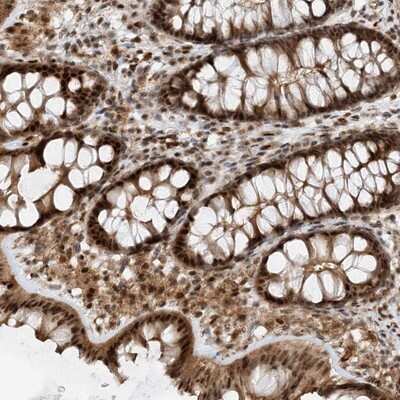 Immunohistochemistry-Paraffin: TATDN3 Antibody [NBP1-91010] - Staining of human colon shows strong nuclear, cytoplasmic and membranous positivity in glandular cells.