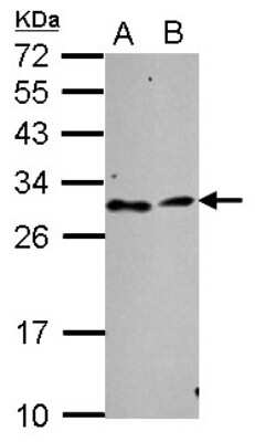 Western Blot: TATDN3 Antibody [NBP2-20573] - Sample (30 ug of whole cell lysate) A: NT2D1 B: SK-N-SH 12% SDS PAGE gel, diluted at 1:1000.