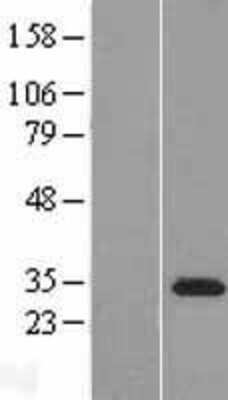 Western Blot: TATDN3 Overexpression Lysate (Adult Normal) [NBP2-08386] Left-Empty vector transfected control cell lysate (HEK293 cell lysate); Right -Over-expression Lysate for TATDN3.