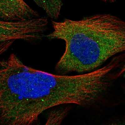 Immunocytochemistry/ Immunofluorescence TAX1BP1 Antibody