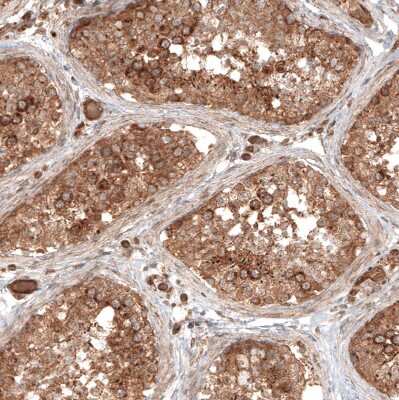 Immunohistochemistry-Paraffin: TAX1BP1 Antibody [NBP1-86662] - Staining of human testis shows strong cytoplasmic positivity in cells in seminiferous ducts.