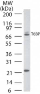 Western Blot TAX1BP1 Antibody