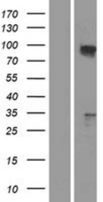 Western Blot TAX1BP1 Overexpression Lysate