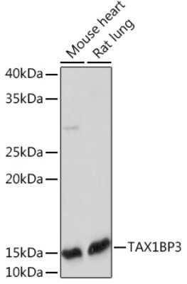 Western Blot: TAX1BP3 Antibody (9T0I1) [NBP3-15919] - Western blot analysis of extracts of various cell lines, using TAX1BP3 Rabbit mAb (NBP3-15919) at 1:1000 dilution. Secondary antibody: HRP Goat Anti-Rabbit IgG (H+L) at 1:10000 dilution. Lysates/proteins: 25ug per lane. Blocking buffer: 3% nonfat dry milk in TBST. Detection: ECL Enhanced Kit. Exposure time: 180s.