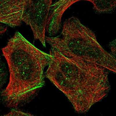 Immunocytochemistry/Immunofluorescence: TAX1BP3 Antibody [NBP2-55345] - Staining of human cell line U-2 OS shows localization to nucleoli fibrillar center & actin filaments.
