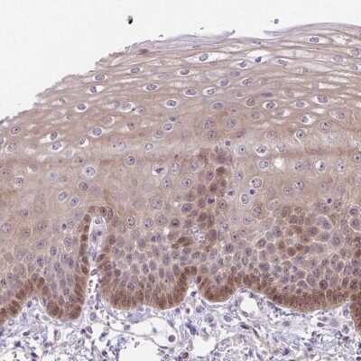 Immunohistochemistry-Paraffin: TAX1BP3 Antibody [NBP2-38016] - Staining of human esophagus shows cytoplasmic and nuclear positivity in squamous epithelial cells.