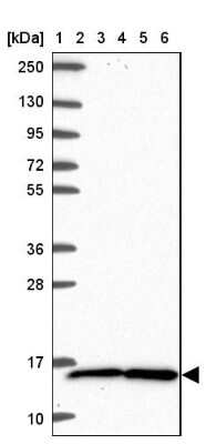 Western Blot: TAX1BP3 Antibody [NBP2-38016] - Lane 1: Marker  [kDa] 250, 130, 95, 72, 55, 36, 28, 17, 10.  Lane 2: Human cell line RT-4.  Lane 3: Human cell line U-251MG.  Lane 4: Human Plasma.  Lane 5: Human liver tissue.  Lane 6: Human tonsil tissue