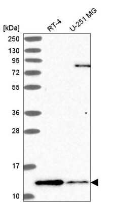 Western Blot: TAX1BP3 Antibody [NBP2-55345] - Western blot analysis in human cell line RT-4 and human cell line U-251 MG.
