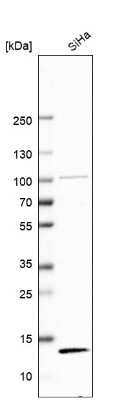 Western Blot: TAX1BP3 Antibody [NBP2-55345] - Analysis in human cell line SiHa.