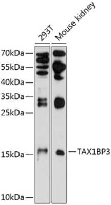 Western Blot: TAX1BP3 Antibody [NBP2-93739] - Analysis of extracts of various cell lines, using TAX1BP3 at 1:1000 dilution. Secondary antibody: HRP Goat Anti-Rabbit IgG (H+L) at 1:10000 dilution. Lysates/proteins: 25ug per lane. Blocking buffer: 3% nonfat dry milk in TBST. Detection: ECL Basic Kit . Exposure time: 90s.