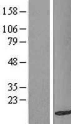 Western Blot: TAX1BP3 Overexpression Lysate (Adult Normal) [NBL1-16717] Left-Empty vector transfected control cell lysate (HEK293 cell lysate); Right -Over-expression Lysate for TAX1BP3.