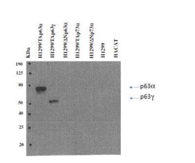 Western Blot: TAp63 Antibody (TAp63-4.1) [NBP3-11703] -  Analysis, confirming specificity of mouse monoclonal antibody TAp63-4.1 for TAp63 isoform of p63 protein. Cell lysates from particular transfectants of TAp63alpha, TAp63gamma, deltaNp63alpha, TAp73alpha, and deltaNp73alpha were analysed. 