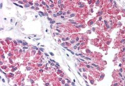Immunohistochemistry-Paraffin: TBC1D1 Antibody [NB100-80834] - Staining of human prostate. Immunohistochemistry of formalin-fixed, paraffin-embedded tissue after heat-induced antigen retrieval. Antibody concentration 5 ug/ml.