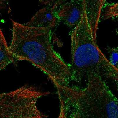 Immunocytochemistry/Immunofluorescence: TBC1D10A Antibody [NBP2-55894] - Staining of human cell line SK-MEL-30 shows localization to plasma membrane.