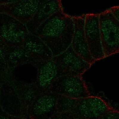 Immunocytochemistry/Immunofluorescence: TBC1D10A Antibody [NBP2-58911] - Staining of human cell line RT4 shows localization to nucleoplasm & plasma membrane.