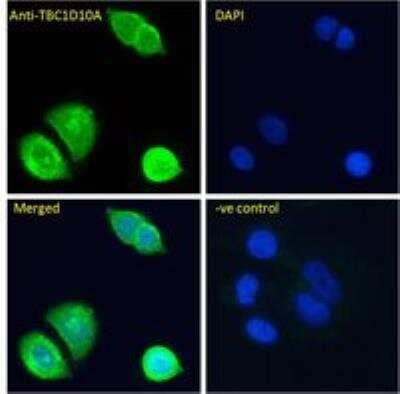 Immunocytochemistry/Immunofluorescence: TBC1D10A Antibody [NBP2-61998] - Paraformaldehyde fixed MCF7 cells, permeabilized with 0.15% Triton. Primary incubation 1hr (10 ug/ml) followed by Alexa Fluor 488 secondary antibody (4 ug/ml), showing cytoplasmic/Plasma Membrane and nuclear staining. The nuclear stain is DAPI (blue). Negative control: Unimmunized goat IgG (10 ug/ml) followed by Alexa Fluor 488 secondary antibody (4 ug/ml).