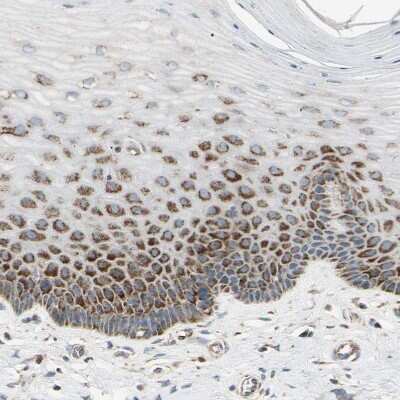 Immunohistochemistry-Paraffin: TBC1D10A Antibody [NBP1-89294] - Staining of human cervix shows strong granular cytoplasmic  positivity in squamous epithelial cells.